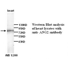 ANG2 Antibody (Rabbit Polyclonal)