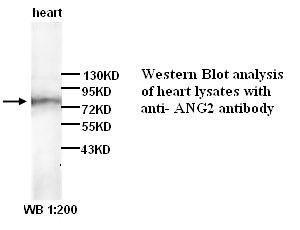 ANG2 Antibody (Rabbit Polyclonal)