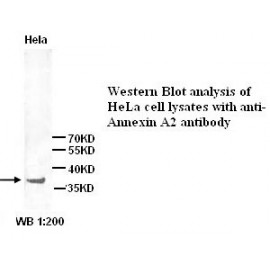 Annexin A2 Antibody (Rabbit Polyclonal)