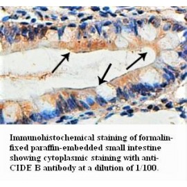 CIDEB Antibody (Rabbit Polyclonal)