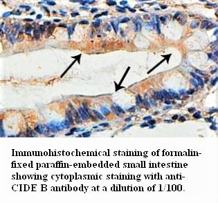 CIDEB Antibody (Rabbit Polyclonal)