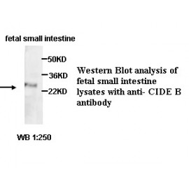 CIDEB Antibody (Rabbit Polyclonal)