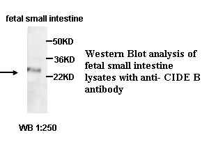 CIDEB Antibody (Rabbit Polyclonal)