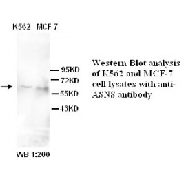 ASNS Antibody (Rabbit Polyclonal)