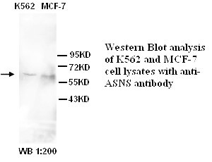 ASNS Antibody (Rabbit Polyclonal)