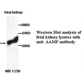 AAMP Antibody (Rabbit Polyclonal)