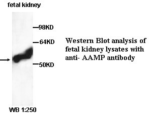 AAMP Antibody (Rabbit Polyclonal)
