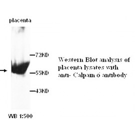 Calpain 6 Antibody (Rabbit Polyclonal)