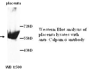 Calpain 6 Antibody (Rabbit Polyclonal)