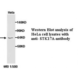 STK17A Antibody (Rabbit Polyclonal)