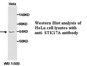 STK17A Antibody (Rabbit Polyclonal)