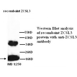 ZCSL3 Antibody (Rabbit Polyclonal)