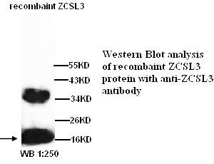 ZCSL3 Antibody (Rabbit Polyclonal)
