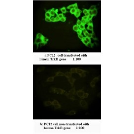 TRKB Antibody (Rabbit Polyclonal)