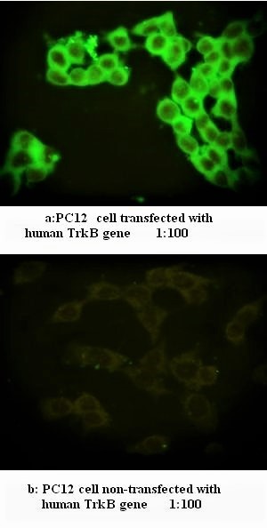 TRKB Antibody (Rabbit Polyclonal)