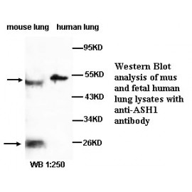 ASH1 Antibody (Rabbit Polyclonal)