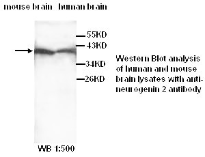 Neurogenin 2 antibody (Rabbit Polyclonal)