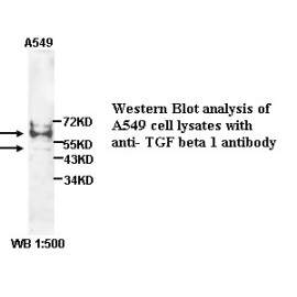 TGF beta1 Antibody (Rabbit Polyclonal)