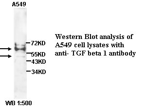 TGF beta1 Antibody (Rabbit Polyclonal)