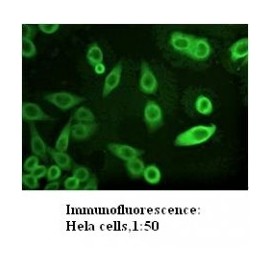  AKR1C3 Antibody