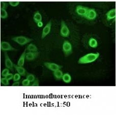  AKR1C3 Antibody