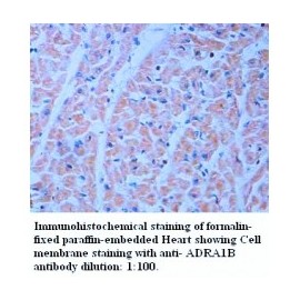  ADRA1B Antibody
