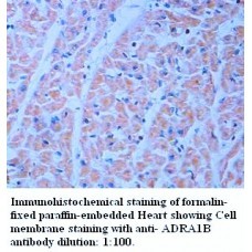  ADRA1B Antibody