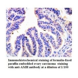  AMH Antibody