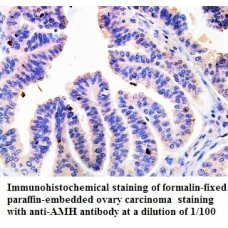  AMH Antibody
