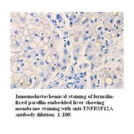  TNFRSF12A Antibody