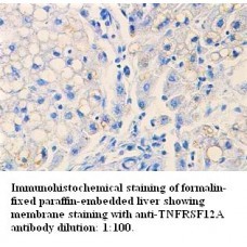  TNFRSF12A Antibody