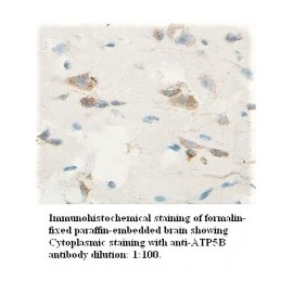  ATP5B Antibody