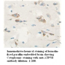  ATP5B Antibody