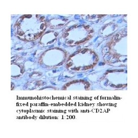  CD2AP Antibody