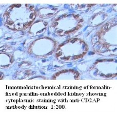  CD2AP Antibody