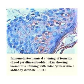 Cytokeratin-1 Antibody