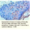 Cytokeratin-1 Antibody