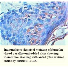 Cytokeratin-1 Antibody