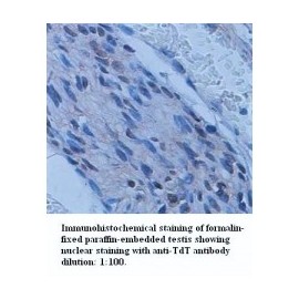  TdT Antibody