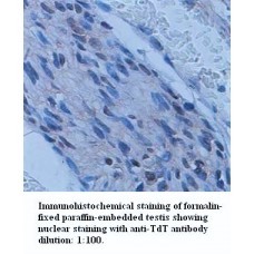  TdT Antibody