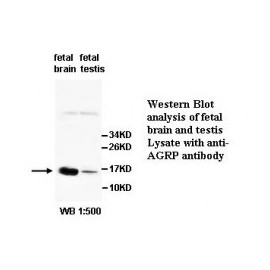  AGRP Antibody