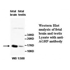  AGRP Antibody