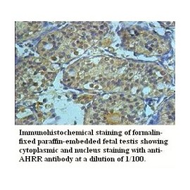  AHRR Antibody