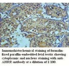  AHRR Antibody