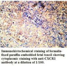  CXCR1 Antibody