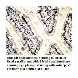  TPCN2 Antibody