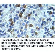  AIM2 Antibody