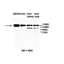 ABCA3 Antibody