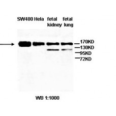  ABCA3 Antibody