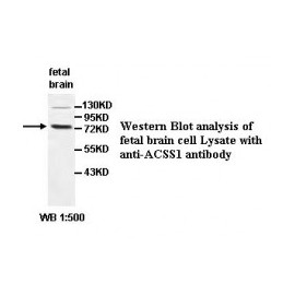  ACSS1 Antibody